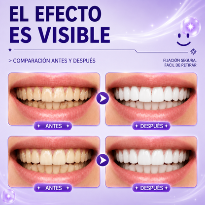 Tratamiento Blanqueador Dental